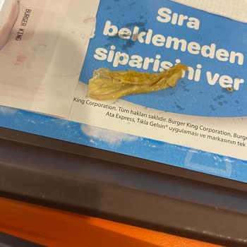 Burger King Hijyen Yok Kıl Çıktı Yemekte