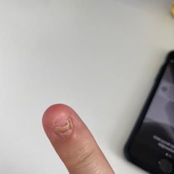 Lila Beauty Art Protez Tırnak Faciası