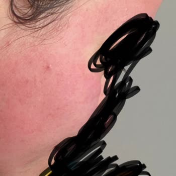 Claderm Yüz Maskesi Yüzümü Yaktı!