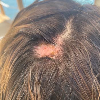 Hair World (Bursa) Kafam Yandı