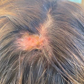 Hair World (Bursa) Kafam Yandı