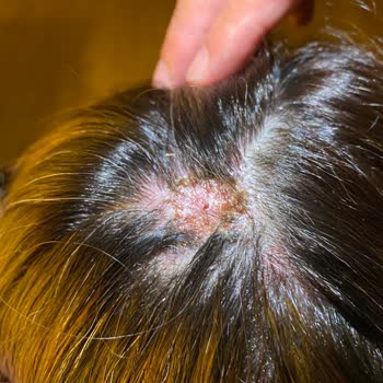 Hair World (Bursa) Kafam Yandı