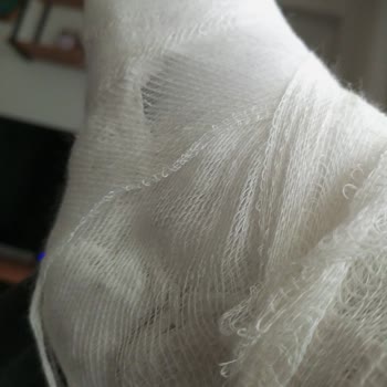 Lapseki Devlet Hastanesi Alçı Malzemesinin Kalitesizliği