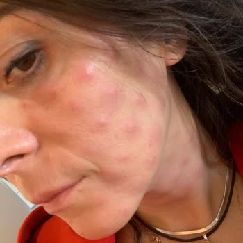 Aylin Çetinkaya Büyük Hayal Kırıklığı