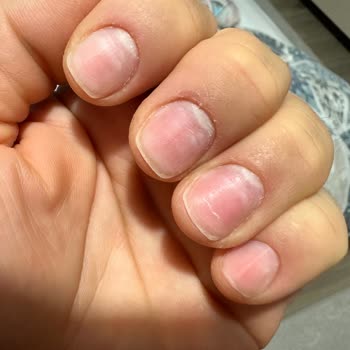 Eylül Öztürk Nail Spa Gebze Şubesi Sorunlu İşlem