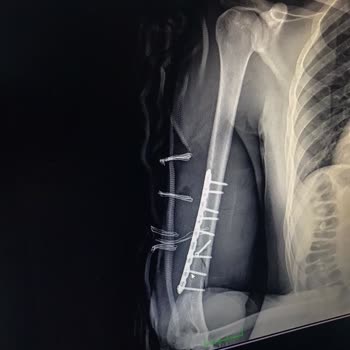 ZIEBART Herhangi Bir Fatura Kesmedi