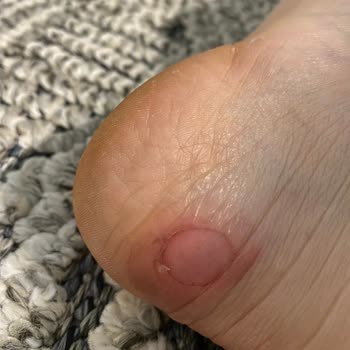 Yargıcı Bağcıklı Bot İadesi