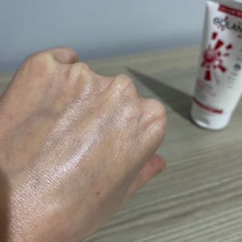 Solante Acnes Ürün Yapısı Değiştirilmiş Performans Aynı Değil