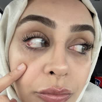 Luxe Optik Göz Sağlığımı Bozdu