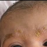 Sebamed Bebek Şampuanı Yaralar Yaptı