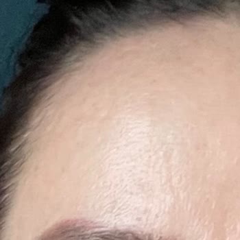 Aylin Çetinkaya Microblading İşleminde Başarısız!