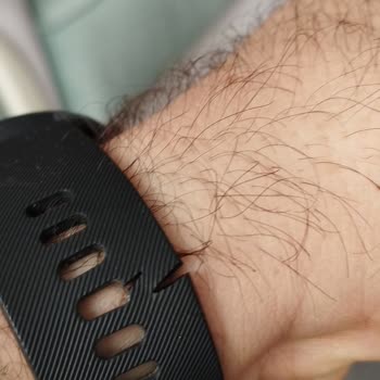 Xiaomi Akıllı Saatimin Kordonun Kopması