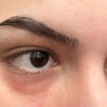 Isana Hydro Booster Roll-on Göz Altı Serumu Memnuniyetsizliği