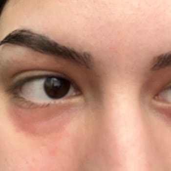 Isana Hydro Booster Roll-on Göz Altı Serumu Memnuniyetsizliği