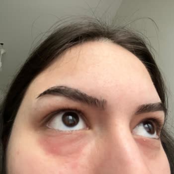 Isana Hydro Booster Roll-on Göz Altı Serumu Memnuniyetsizliği