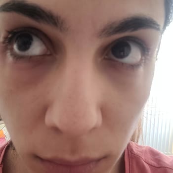 She Vec Cosmetics Göz Altı Serum Mağduriyeti