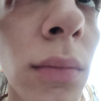 She Vec Cosmetics Göz Altı Serum Mağduriyeti