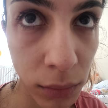 She Vec Cosmetics Göz Altı Serum Mağduriyeti