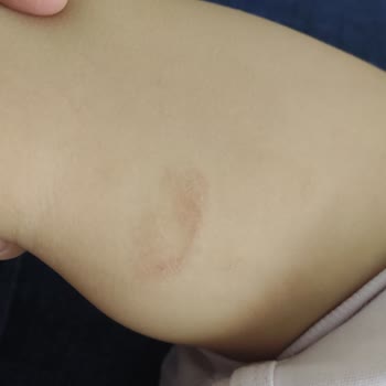 Besafe Oto Koltuk Koruyucu Kemer Bağlantısı Kızımın Ayağını Kesti!