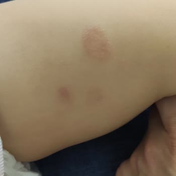 Besafe Oto Koltuk Koruyucu Kemer Bağlantısı Kızımın Ayağını Kesti!