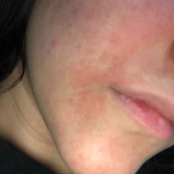 Rise & Shine Maderise Ve Sabun Menuniyetsizliği