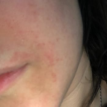 Rise & Shine Maderise Ve Sabun Menuniyetsizliği