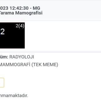 Polatlı Duatepe Devlet Hastanesi Mamografi Röntgen Çekimi