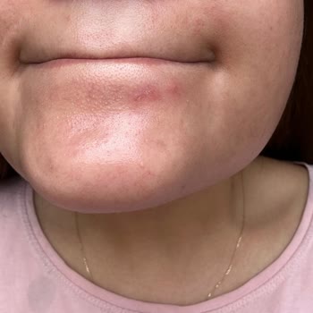 Herbaderm Cilt Bakım Ürünleri