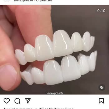 Smilexpresstr (Instagram) Farklı Plastik Bir Ürün Geldi