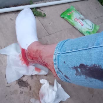 aksu belediyesi köpek saldırıs  oldu acil toplatılması lazım