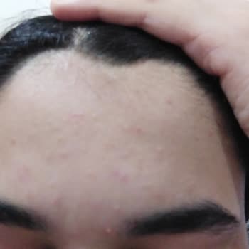 Rise & Shine Aloe Vera Sabun Cildimi Mahvetti