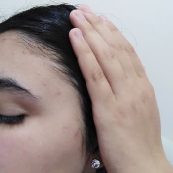 Rise & Shine Aloe Vera Sabun Cildimi Mahvetti