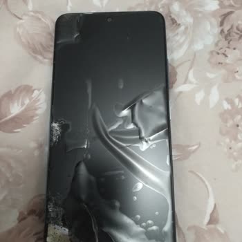 Xiaomi Yetkili Servis Yetersizliği!