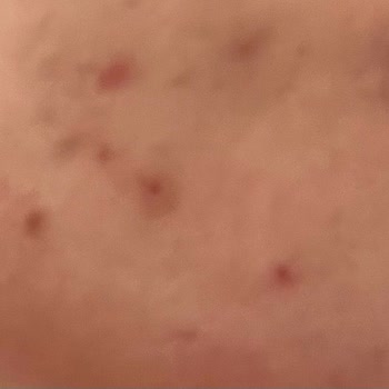 Dünya Eczanesi Cildimi Bozdu, Fiyat Aşırı Pahalı, Hizmet Yetersiz