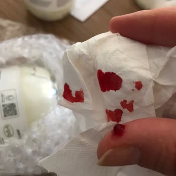 The Lifeco Thelifeco Kargodan Çıkan Kırık Kavanozu Parmağımı Kesti