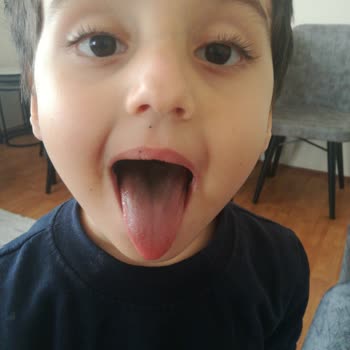 Torku Premio Bisküvi Renk Sorunu