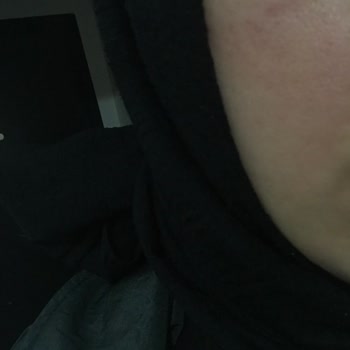 Solante Şüpheli Ürün