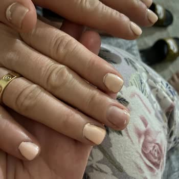 Wo&Es White Güzellik Merkezi Memnuniyetsizliği!