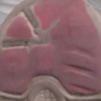 Slazenger Malzeme Kalitesi Ve Müşteri Memnuniyetsizliği!