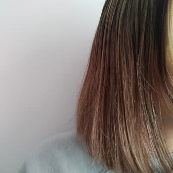 Üçons Kuaför Başarısız Saç Boyama İşlemi