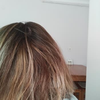 Üçons Kuaför Başarısız Saç Boyama İşlemi