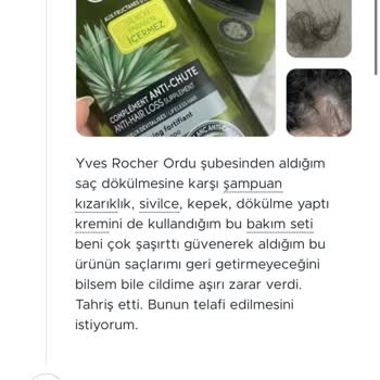 Saçlarımı Döken Yves Rocher Şampuan Sonucu Karşılık Dönüş Yapılmadı