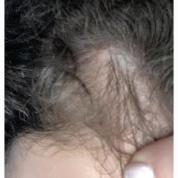 Saçlarımı Döken Yves Rocher Şampuan Sonucu Karşılık Dönüş Yapılmadı