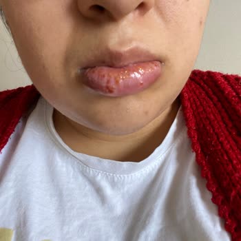 Gratis İnsan Sağlığıyla Oynuyor