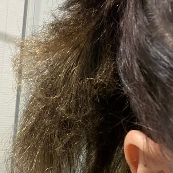 Çetin Tekin Hair Studio Göktürk Saçlarımı Yaktı