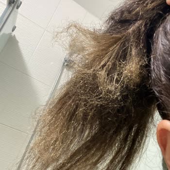 Çetin Tekin Hair Studio Göktürk Saçlarımı Yaktı