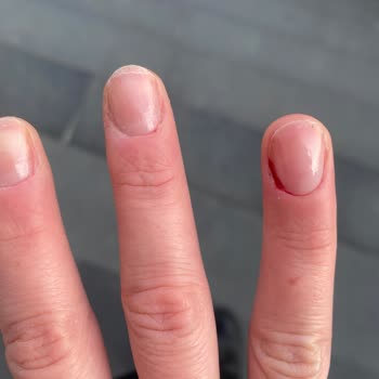 Aslife Health Club Kanatarak, Temizlemeden Yapılan Manikür