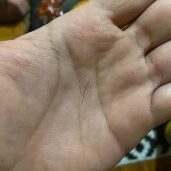 A101 Paketli Ürün Hatası