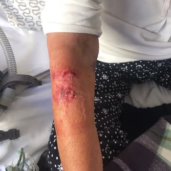 Maltepe Üniversitesi Tıp Fakültesi Hastaneleri Maltepe Ü. Hastanesi Sorumsuzluğu