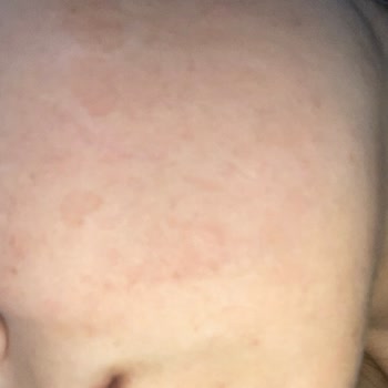 Rise & Shine Sabun Sivilce Yaptı